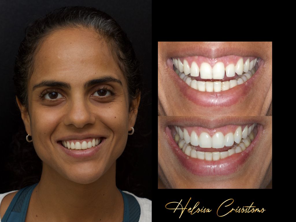 Resultado Dental Concept 3